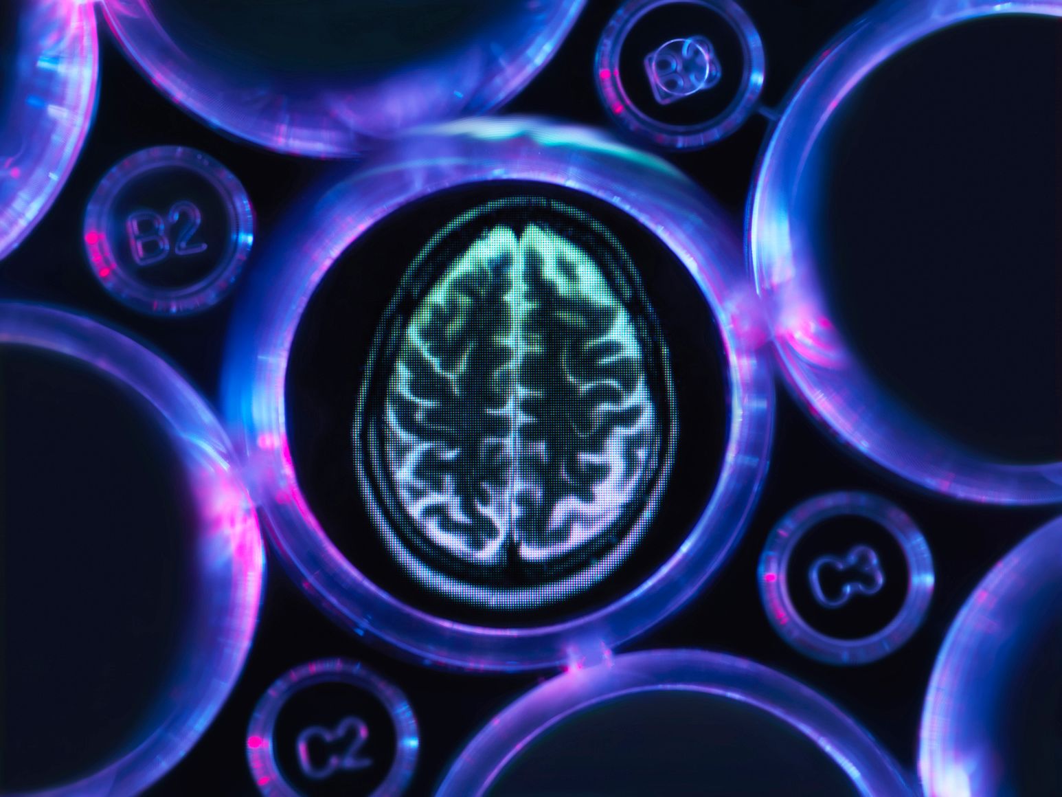 An image of a brain scan