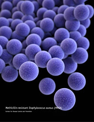 Staph aureus-USDA/ARS staph aureus-USDA-ARS