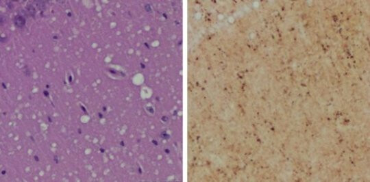 Prion images Prion-images